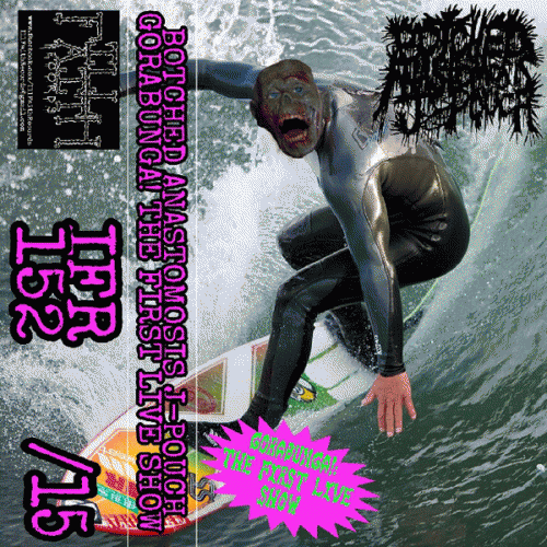 Botched Anastomosis J-Pouch : Gorabunga!